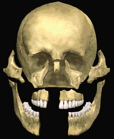 Facial Trauma Skeleton